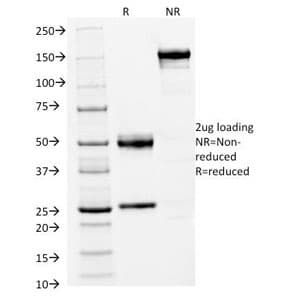 FOXA1 Antibody (clone FOXA1/1512, Azide-free, BSA-free)