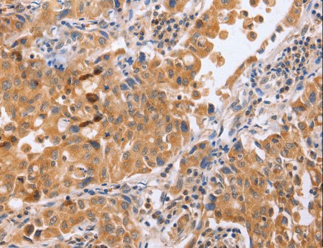 BLNK Antibody