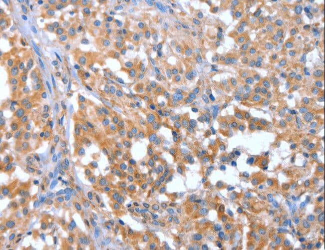NOD2 / CARD15 Antibody