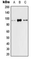 VR1 / TRPV1 Antibody (N-Terminus)