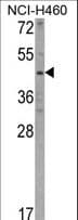 KYNU Antibody (aa359-386)