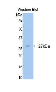 IL4R / CD124 Antibody (aa26-232)