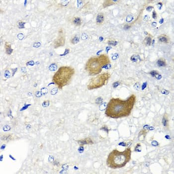 IFNL1 / IL29 Antibody