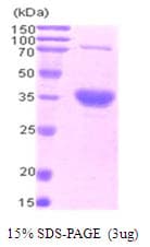 Human BIRC7 / Livin Protein (Recombinant His)