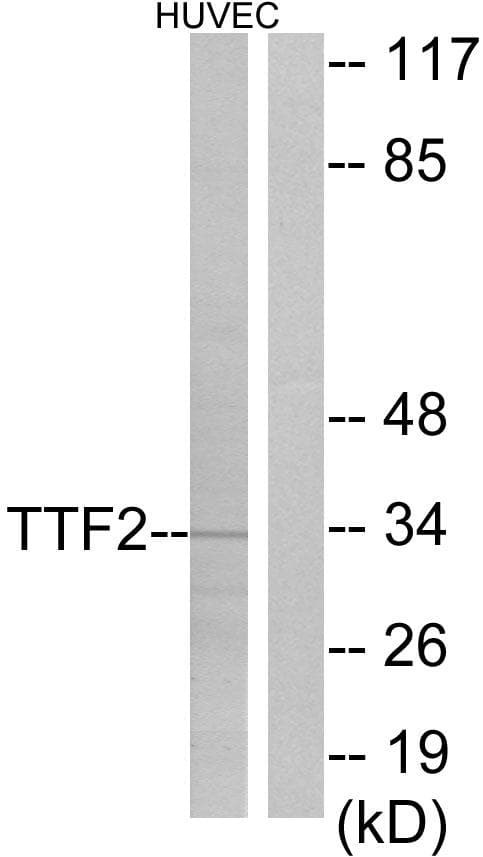 Polyclonal Rabbit anti-Human TTF2 / HuF2 Antibody (WB)