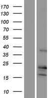 p14ARF / CDKN2A Protein (Over-Expression Lysate Myc-DDK (Flag))
