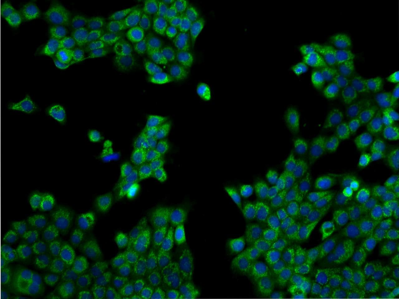 Polyclonal Rabbit anti-Human TEX9 Antibody (IHC, IF)