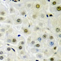 DTNBP1 / Dysbindin Antibody