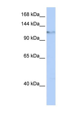 Polyclonal Rabbit anti-Human HELLS Antibody (aa756-805, WB)