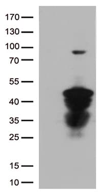 CTSL / Cathepsin L Antibody (aa114-333, clone OTI5C8)