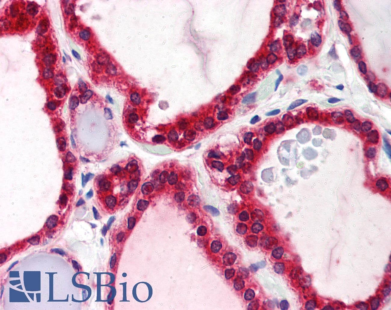 IHC-plus™ GOK / STIM1 Antibody (C-Terminus, clone CDN3H4)