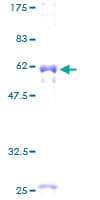 Human MYOZ2 / CS-1 Protein (Recombinant GST)