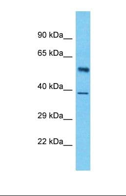 LUC7L3 / CROP Antibody (aa247-296)