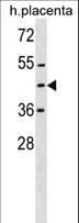 ZNF558 Antibody (aa120-147)