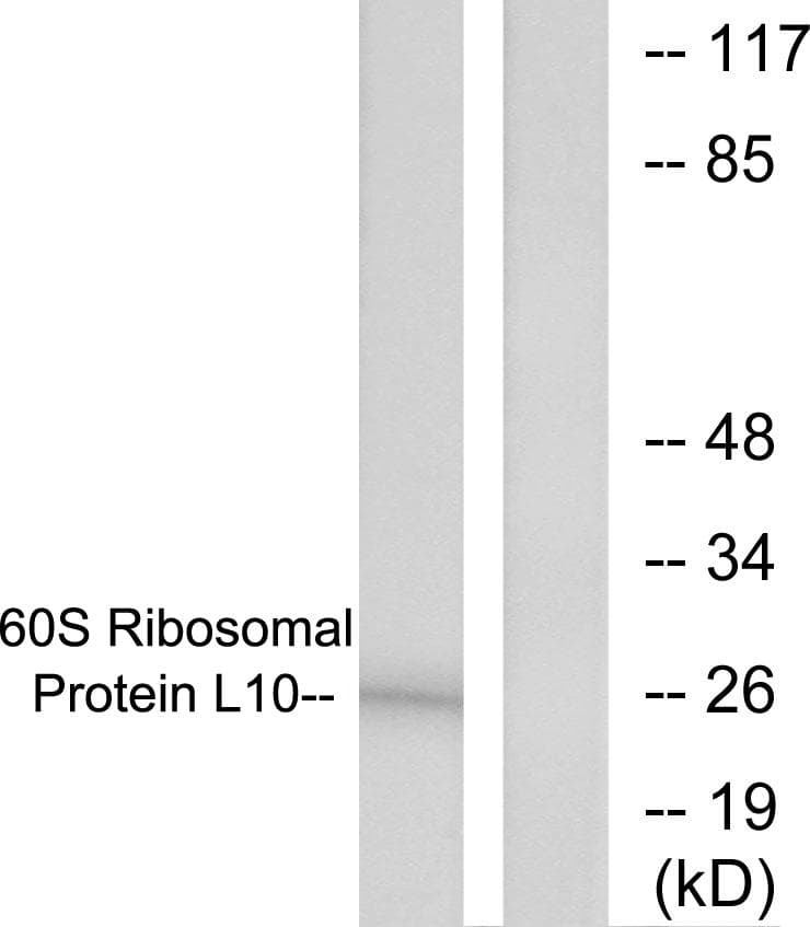Polyclonal Rabbit anti-Human RPL10 / Ribosomal Protein L10 Antibody (WB)