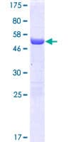 Human FAM78A Protein (Recombinant GST)
