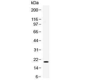 Polyclonal Rabbit anti-Human TREML1 / TLT1 Antibody (WB)