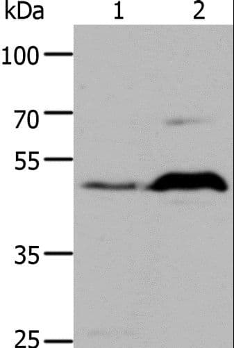 IHC-plus™ Polyclonal Rabbit anti-Human HTR1A / 5-HT1A Receptor Antibody (IHC, WB)