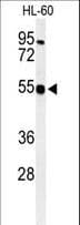 Polyclonal Rabbit anti-Human HS2ST1 Antibody (aa16-45, IHC, WB)