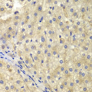 NEK8 Antibody
