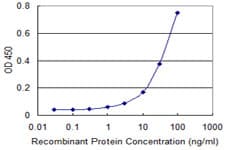 AK1 / Adenylate Kinase 1 Antibody (clone 3G8-1B11)