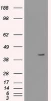 KRT19 / CK19 / Cytokeratin 19 Antibody (clone OTI4E12)