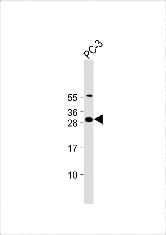 Polyclonal Rabbit anti-Human FAM125A Antibody (N-Terminus, IF, WB)