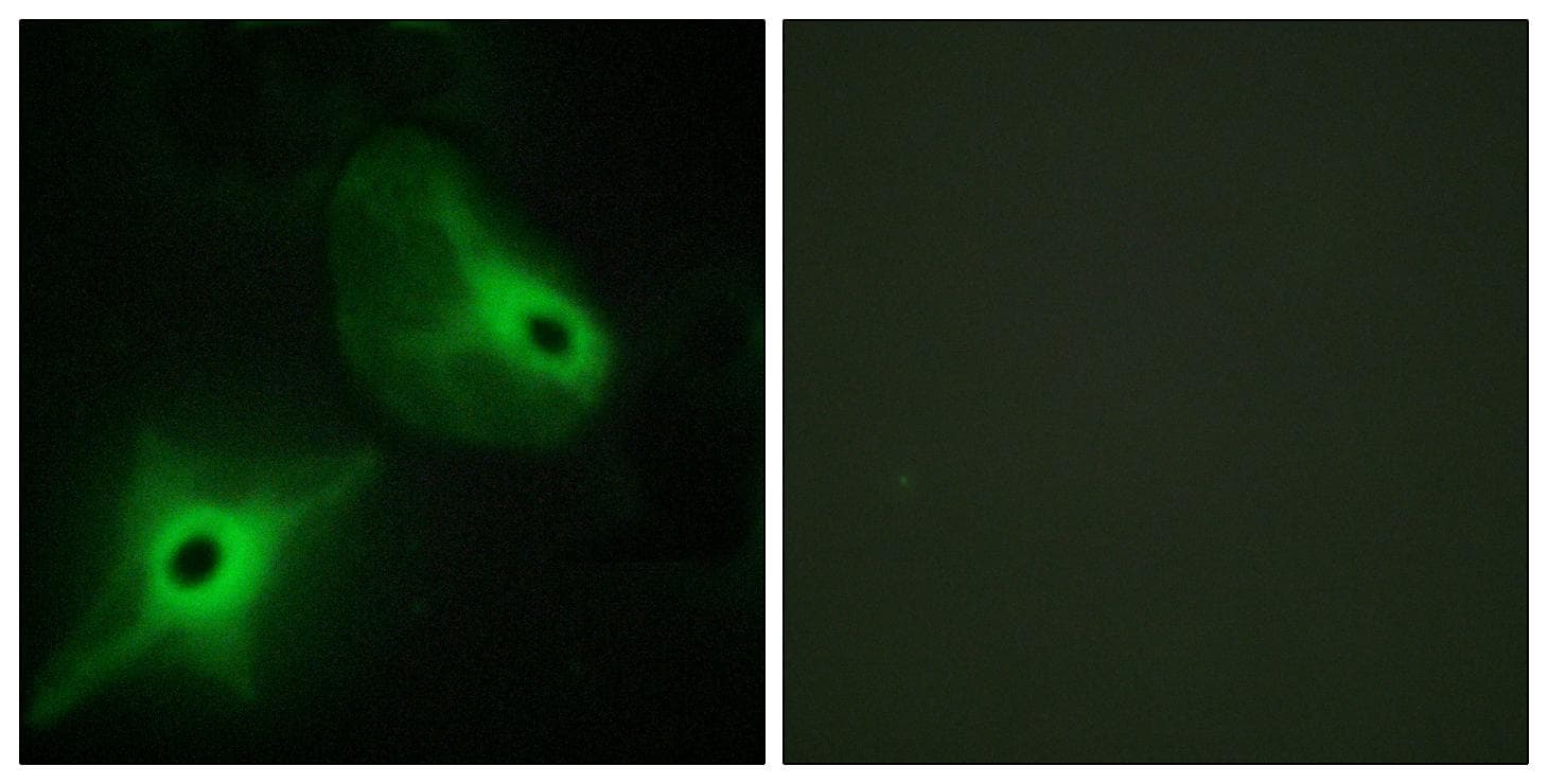Polyclonal Rabbit anti-Human KSR2 Antibody (IF, WB)