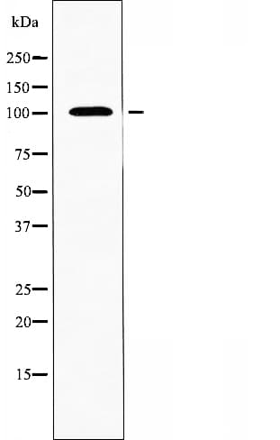 ARHGAP17 / NADRIN Antibody