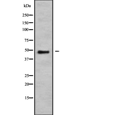 NMUR1 Antibody