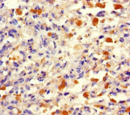 TRMT112 Antibody