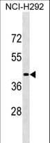 Polyclonal Rabbit anti-Human LIPN Antibody (aa279-308, WB)