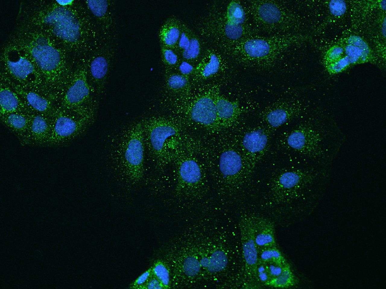 CLCN2 Antibody