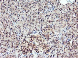 MEIS3 Antibody (aa1-261, clone OTI2E12, Carrier-free)