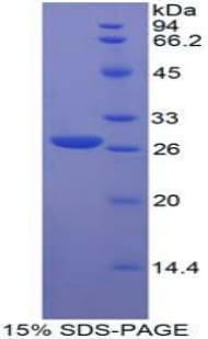 Human FGFRL1 Protein (Recombinant His-T7)