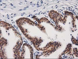 CTNNB1 / Beta Catenin Antibody (clone OTI6A3)