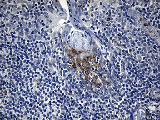 FBXO6 Antibody (clone OTI7A10)