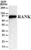 IHC-plus™ TNFRSF11A / RANK Antibody (aa326-616, clone 9A725)