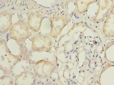 Polyclonal Rabbit anti-Human TMEM174 Antibody (IHC, WB)