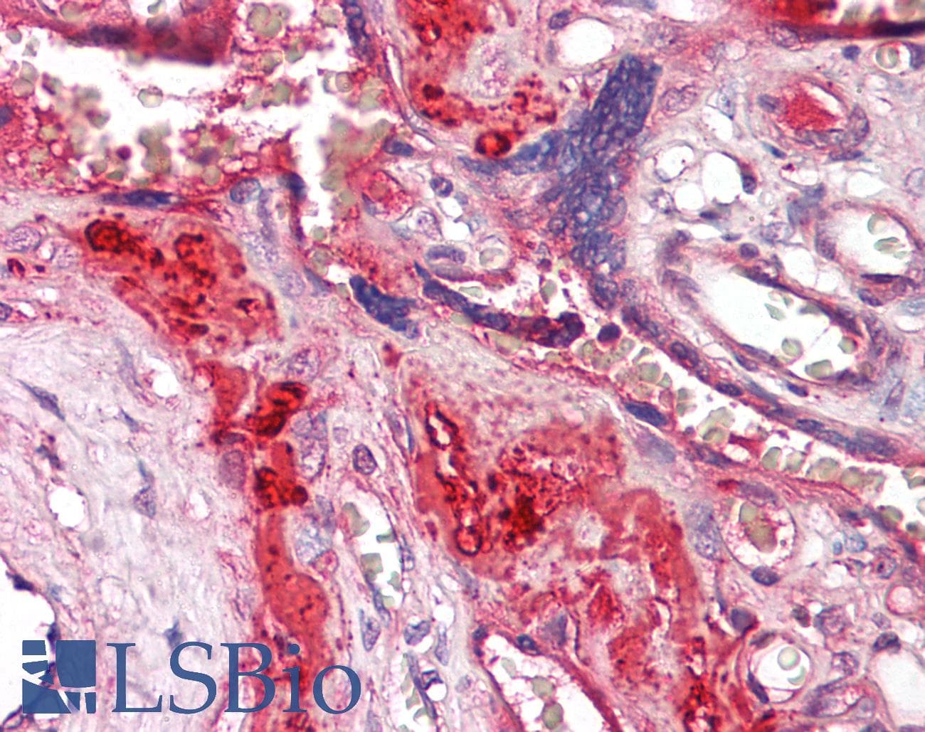 IHC-plus™ Monoclonal Mouse anti-Human VTN / Vitronectin Antibody (IHC, WB)