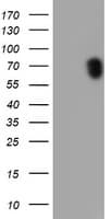 RPS6KB1 / P70S6K / S6K Antibody (clone OTI1G4, Carrier-free)