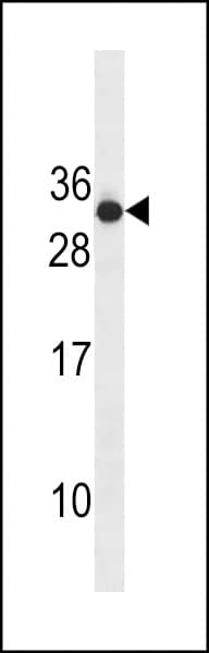 IHC-plus™ Polyclonal Rabbit anti-Human RAB4B Antibody (aa29-58, IHC, WB)