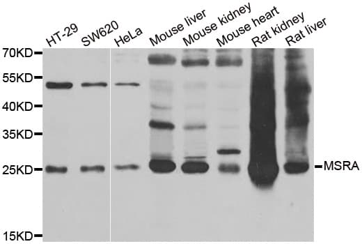 Polyclonal Rabbit anti-Human MSRA Antibody (IHC, IF, WB)