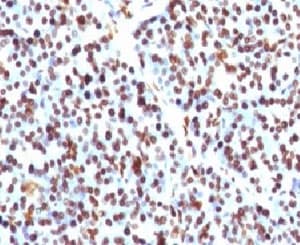Histone H1 Antibody (clone OSHT-2)