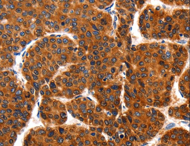 TRAP1 / HSP75 Antibody