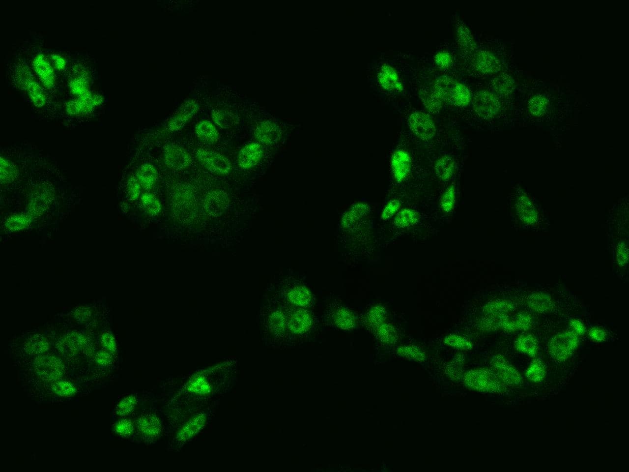 Polyclonal Rabbit anti-Human ZIM2 Antibody (IF)