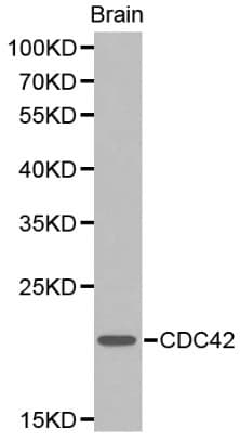 Polyclonal Rabbit anti-Human CDC42 Antibody (IHC, WB)
