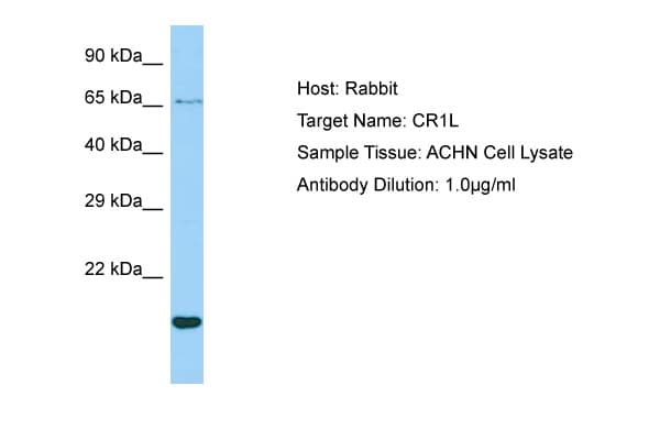 CR1L / CRRY Antibody (aa57-106)