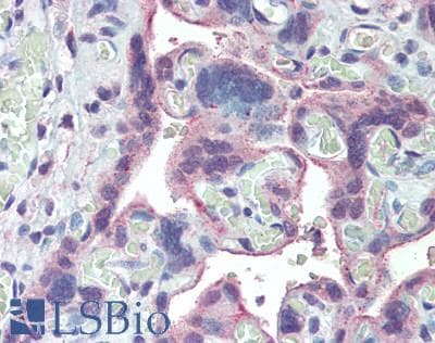 IHC-plus™ PLXNB1 / Plexin-B1 Antibody