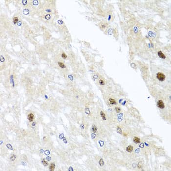 Polyclonal Rabbit anti-Human YTHDF3 Antibody (IHC, WB)